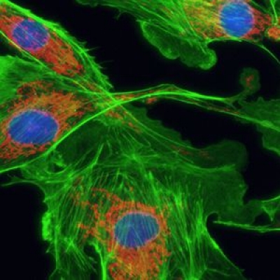 怎么提高顯微鏡的熒光成像的質(zhì)量？